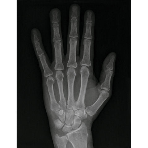 Full Speed X-Ray Film - Green